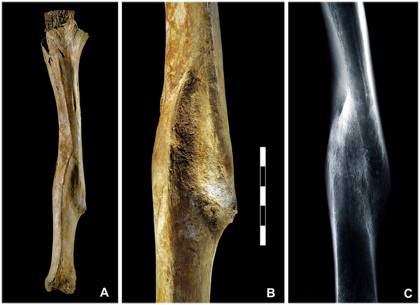 Ein Bild, das Screenshot, Röntgenfilm enthält.

KI-generierte Inhalte können fehlerhaft sein.